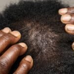 Why Your Hair Isn’t Healing—And How the Right Hair Recovery Conditioner Can Fix It Fast